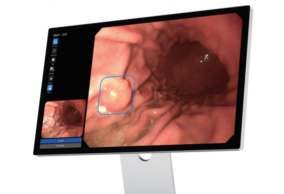 Phần mềm AI hỗ trợ chẩn đoán và phân loại tổn thương cho dạ dày và đại tràng